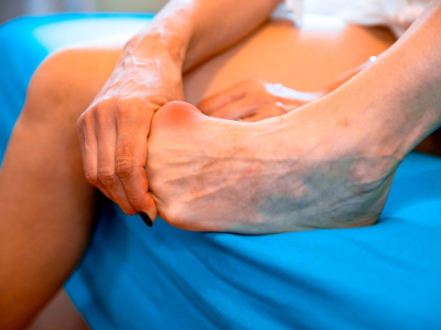 Minimalistisches Schuhwerk im Vergleich zu verschiedenen Arten von Fußdeformität